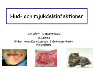 Hud- och mjukdelsinfektioner