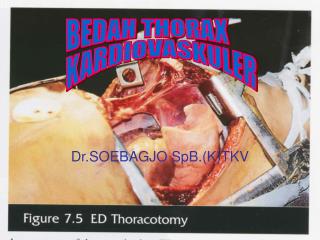 Dr.SOEBAGJO SpB.(K)TKV