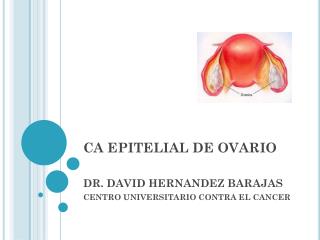 CA EPITELIAL DE OVARIO