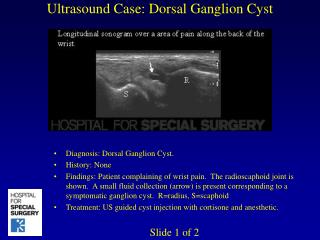 Ultrasound Case: Dorsal Ganglion Cyst