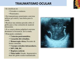 TRAUMATISMO OCULAR