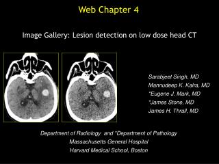 Image Gallery: Lesion detection on low dose head CT