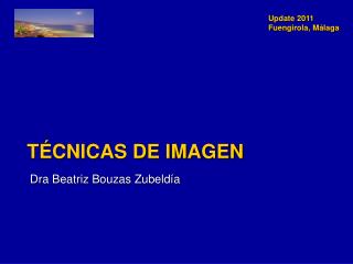 Técnicas de Imagen