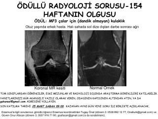 ÖDÜLLÜ RADYOLOJİ SORUSU-154 HAFTANIN OLGUSU ÖDÜL: MP3 çalar için (dandik olmayan) kulaklık