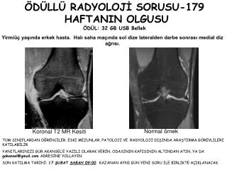 ÖDÜLLÜ RADYOLOJİ SORUSU-179 HAFTANIN OLGUSU ÖDÜL: 32 GB USB Bellek