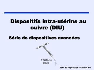 Dispositifs intra-utérins au cuivre (DIU)