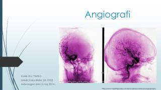 Angiografi