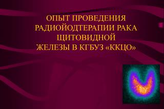 ОПЫТ ПРОВЕДЕНИЯ РАДИОЙОДТЕРАПИИ РАКА ЩИТОВИДНОЙ ЖЕЛЕЗЫ В КГБУЗ «ККЦО»