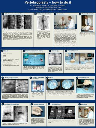 Possible complications Bleeding Infection Fracture of the pedicle