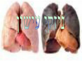 ניזקי עישון