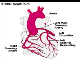 ENFERMEDAD CORONARIA