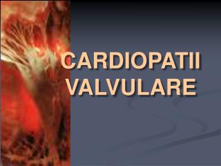 CARDIOPATII VALVULARE