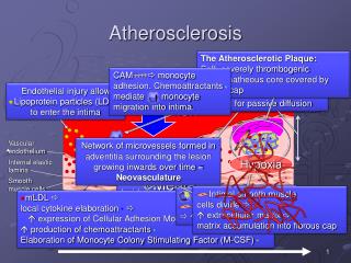 Atherosclerosis