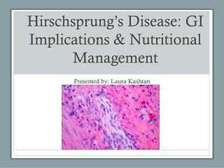 Hirschsprung’s Disease: GI Implications &amp; Nutritional Management