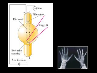 i raggi X di frenamento