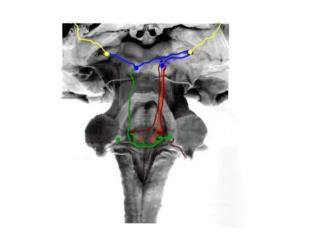 Brainstem