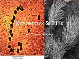 Ribosomes &amp; Cilia