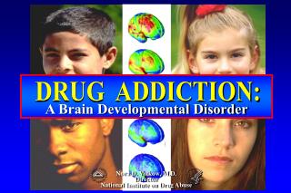 A Brain Developmental Disorder