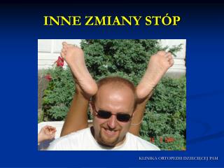INNE ZMIANY STÓP