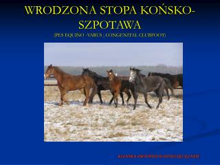 WRODZONA STOPA KOŃSKO-SZPOTAWA (PES EQUINO -VARUS ; CONGENITAL CLUBFOOT)
