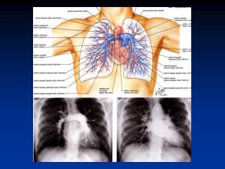 Central hemodynamic findings in normal subjects