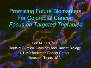 Promising Future Biomarkers For Colorectal Cancer: Focus on Targeted Therapies