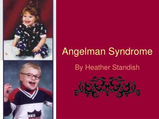 Angelman Syndrome