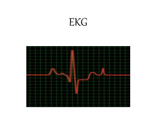 EKG