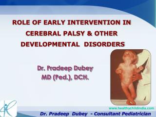 Dr. Pradeep Dubey MD (Ped.), DCH.