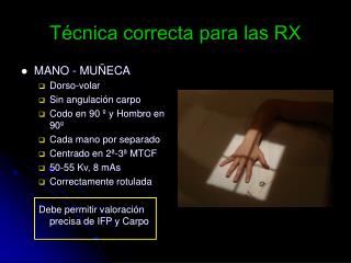 Técnica correcta para las RX