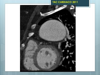 TAC CARDIACO 2011