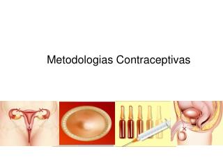 Metodologias Contraceptivas