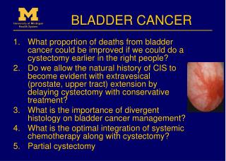 BLADDER CANCER