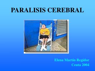 PARALISIS CEREBRAL