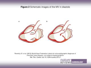 Figure 2 Schematic images of the MV in diastole