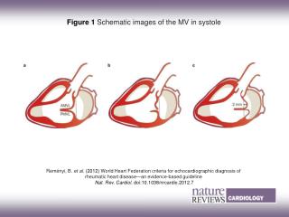 Figure 1 Schematic images of the MV in systole