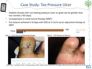 Case Study: Toe Pressure Ulcer