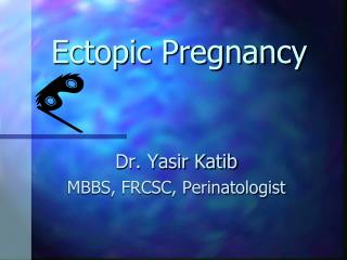 Ectopic Pregnancy