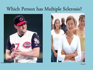 Which Person has Multiple Sclerosis?