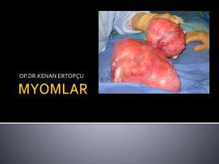 MYOMLAR