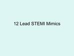12 Lead STEMI Mimics