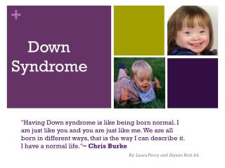 Down Syndrome