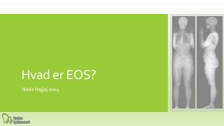 Hvad er EOS?