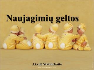 Naujagimių geltos