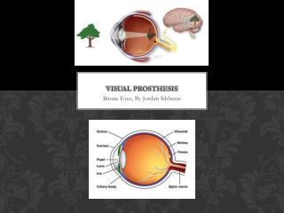 Visual prosthesis