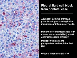 Pleural fluid cell block from nonfatal case