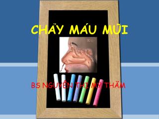 CHẢY MÁU MŨI