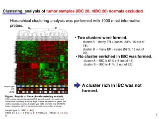 Clustering analysis of tumor samples (IBC 20, nIBC 20) normals excluded
