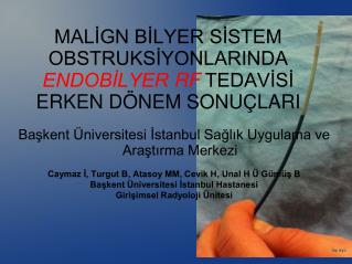 MALİGN BİLYER SİSTEM OBSTRUKSİYONLARINDA ENDOBİLYER RF TEDAVİSİ ERKEN DÖNEM SONUÇLARI