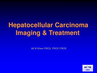Hepatocellular Carcinoma Imaging &amp; Treatment